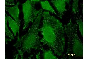 Immunofluorescence (IF) image for anti-Protein Phosphatase 2, Regulatory Subunit B', delta (PPP2R5D) (AA 514-602) antibody (ABIN519130)