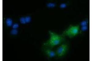 Anti-FAM84B mouse monoclonal antibody (ABIN2453030) immunofluorescent staining of COS7 cells transiently transfected by pCMV6-ENTRY FAM84B (RC207996). (FAM84B Antikörper)