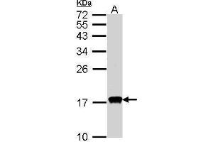 WB Image Sample(30 ug whole cell lysate) A:HeLa S3, 15% SDS PAGE antibody diluted at 1:1000 (CDA Antikörper)