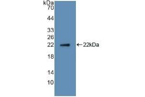 Detection of Recombinant RANkL, Human using Polyclonal Antibody to Receptor Activator Of Nuclear Factor Kappa B Ligand (RANkL)