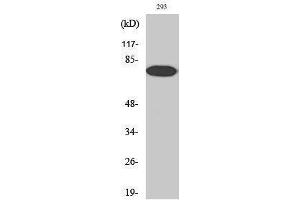 Western Blotting (WB) image for anti-Nuclear Factor-kB p65 (NFkBP65) (pThr254) antibody (ABIN3182091) (NF-kB p65 Antikörper  (pThr254))