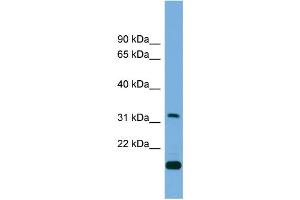 WB Suggested Anti-CTDSP2  Antibody Titration: 0. (CTDSP2 Antikörper  (Middle Region))