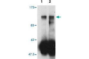 Western blot analysis of immunoprecipitates from mouse cell line lysates using Farp2 polyclonal antibody. (FARP2 Antikörper)
