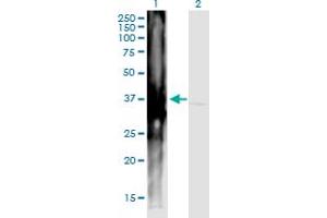 Western Blot analysis of ART4 expression in transfected 293T cell line by ART4 monoclonal antibody (M01), clone 2F8.