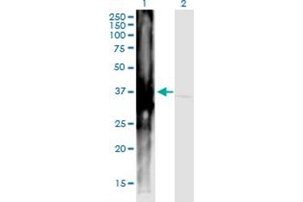 ART4 antibody  (AA 61-160)