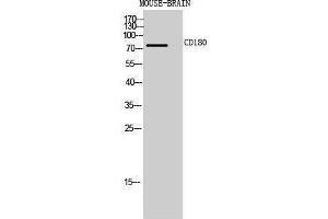 CD180 Antikörper  (Internal Region)