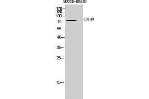 Western Blotting (WB) image for anti-CD180 Molecule (CD180) (Internal Region) antibody (ABIN3181467) (CD180 Antikörper  (Internal Region))