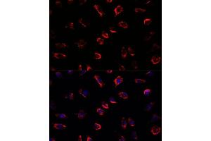 Immunofluorescence analysis of L929 cells using IL11 antibody (ABIN6128128, ABIN6142292, ABIN6142293 and ABIN6219040) at dilution of 1:100. (IL-11 Antikörper  (AA 22-199))