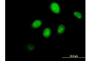 Immunofluorescence of purified MaxPab antibody to RUNX3 on HeLa cell. (RUNX3 Antikörper  (AA 1-429))