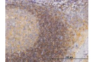 Immunostaining (ISt) image for anti-Phosphoinositide 3-kinase Regulatory Subunit 4 (PIK3R4) (AA 1259-1358) antibody (ABIN565478)