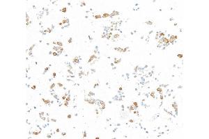 Immunocytochemistry (ICC) image for anti-Nuclear Factor-kB p65 (NFkBP65) (C-Term) antibody (ABIN7795799)