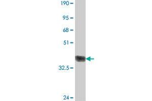 Western Blot detection against Immunogen (37 KDa) . (BMP1 Antikörper  (AA 747-845))