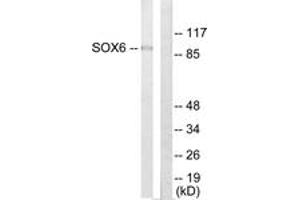 Western Blotting (WB) image for anti-SRY (Sex Determining Region Y)-Box 6 (SOX6) (AA 10-59) antibody (ABIN2889463) (SOX6 Antikörper  (AA 10-59))