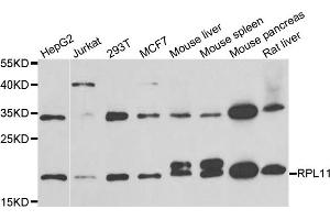 Western blot analysis of extracts of various cell lines, using RPL11 antibody (ABIN5973808) at 1/1000 dilution. (RPL11 Antikörper)