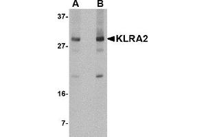 Western Blotting (WB) image for anti-Killer Cell Lectin-Like Receptor, Subfamily A, Member 2 (Klra2) (C-Term) antibody (ABIN1030472) (Klra2 Antikörper  (C-Term))