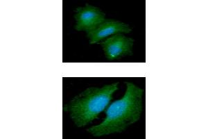 anti-HIV-1 Tat Interactive Protein 2, 30kDa (HTATIP2) (AA 1-242) antibody