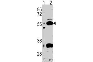 Western blot analysis of PDX1 (arrow) using rabbit PDHX polyclonal antibody . (PDHX Antikörper  (C-Term))