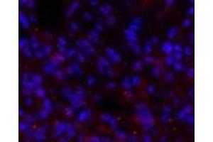 Immunofluorescence analysis of Rat lung tissue using BRCA1 Polyclonal Antibody at dilution of 1:200. (BRCA1 Antikörper)