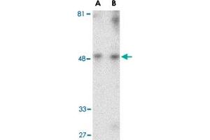 Western blot analysis of HAVCR1 in human uterus tissue lysate with HAVCR1 polyclonal antibody  at (A) 1 and (B) 2 ug/mL . (HAVCR1 Antikörper  (Internal Region))