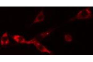 ABIN6274254 staining Hela cells by IF/ICC. (NBL1 Antikörper  (C-Term))