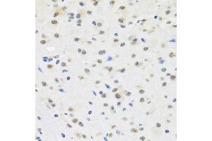 Immunohistochemistry of paraffin-embedded mouse brain using SAFB2 antibody (ABIN5972429) at dilution of 1/100 (40x lens). (SAFB2 Antikörper)