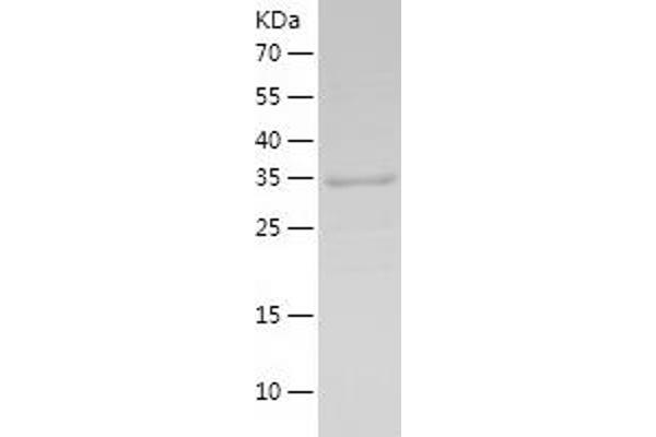 Glutathione Reductase Protein (GSR) (AA 43-522) (His tag)