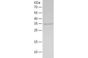 Western Blotting (WB) image for Glutathione Reductase (GSR) (AA 43-522) protein (His tag) (ABIN7123135) (Glutathione Reductase Protein (GSR) (AA 43-522) (His tag))