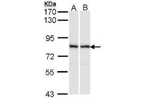WB Image Sample (30 ug of whole cell lysate) A: A431 , B: Raji 7. (RACGAP1 Antikörper  (N-Term))