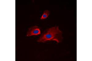 Immunofluorescent analysis of RPS6 (pS235) staining in NIH3T3 cells. (RPS6 Antikörper  (C-Term, pSer235))