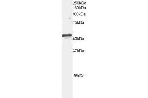 Western Blotting (WB) image for anti-ADP-Ribosylation Factor GTPase Activating Protein 3 (ARFGAP3) (C-Term) antibody (ABIN2465423) (ARFGAP3 Antikörper  (C-Term))