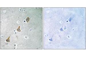 Immunohistochemistry analysis of paraffin-embedded human brain tissue, using PECAM-1 (Ab-713) Antibody. (CD31 Antikörper  (AA 686-735))