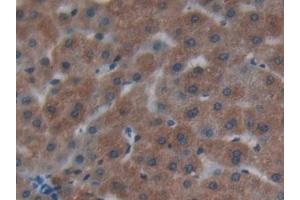 Detection of Cys-C in Human Liver Tissue using Polyclonal Antibody to Cystatin C (Cys-C) (CST3 Antikörper  (AA 27-146))