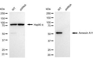 Western blotting analysis using annexin A11 antibody (ABIN7797616).