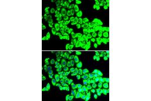 Immunofluorescence analysis of U2OS cells using G3BP1 antibody. (G3BP1 Antikörper)