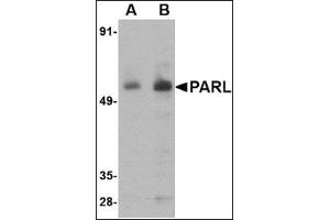 Western blot analysis of PARL in 3T3 cell lysate with this product at (A) 1 and (B) 2 μg/ml. (PARL Antikörper  (N-Term))