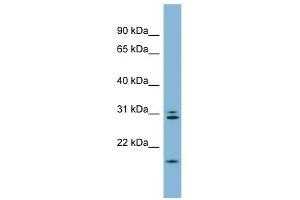 ANAPC10 antibody used at 1 ug/ml to detect target protein. (ANAPC10 Antikörper  (N-Term))