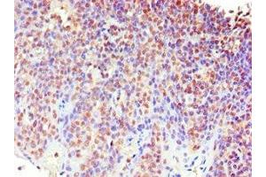 Immunohistochemistry of paraffin-embedded human tonsil tissue using ABIN7159621 at dilution of 1:100 (MECP2 Antikörper  (AA 1-280))