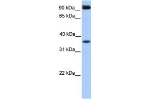 Western Blotting (WB) image for anti-DCN1, Defective in Cullin Neddylation 1, Domain Containing 4 (DCUN1D4) antibody (ABIN2459767) (DCUN1D4 Antikörper)