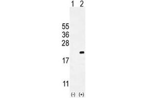 Western blot analysis of CDKN2C antibody and 293 cell lysate either nontransfected (Lane 1) or transiently transfected (2) with the CDKN2C gene. (CDKN2C Antikörper  (AA 113-139))