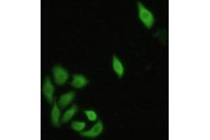 Detection of IRF3 in Hela cells using Polyclonal Antibody to Interferon Regulatory Factor 3 (IRF3) (IRF3 Antikörper  (AA 1-360))