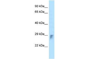 WB Suggested Anti-Rhou Antibody Titration: 1. (RHOU Antikörper  (N-Term))