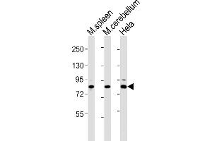 All lanes : Anti-Suz12 Antibody (Center) at 1:2000 dilution Lane 1: mouse spleen lysates Lane 2: mouse cerebellum lysates Lane 3: Hela whole cell lysates Lysates/proteins at 20 μg per lane. (SUZ12 Antikörper  (AA 381-395))