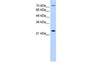 CLDN2 antibody (20R-1258) used at 0. (Claudin 2 Antikörper  (N-Term))