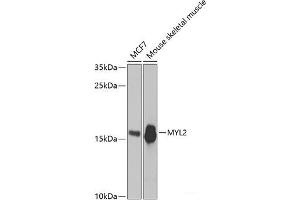 Western blot analysis of extracts of various cell lines using MYL2 Polyclonal Antibody at dilution of 1:3000. (MYL2 Antikörper)