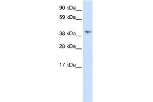 WB Suggested Anti-MSL3L1 Antibody Titration:  0. (MSL3 Antikörper  (C-Term))