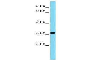 Host: Rabbit Target Name: CDRT15L2 Sample Type: Jurkat Whole Cell lysates Antibody Dilution: 1.
