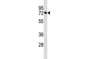 HSPA1L antibody western blot analysis in MDA-MB453 lysate. (HSPA1L Antikörper  (AA 576-603))