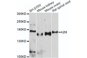 Western blot analysis of extracts of various cell lines, using A2M antibody. (alpha 2 Macroglobulin Antikörper  (AA 1155-1474))