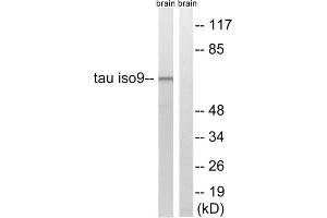 Western blot analysis of extracts from rat brain cells, using Tau (epitope around residue 534/217) antibody.