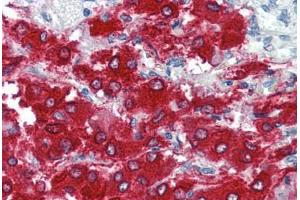 Human Adrenal (formalin-fixed, paraffin-embedded) stained with TH antibody ABIN337188 at 5 ug/ml followed by biotinylated goat anti-rabbit IgG secondary antibody ABIN481713, alkaline phosphatase-streptavidin and chromogen. (Tyrosine Hydroxylase Antikörper  (pSer40))